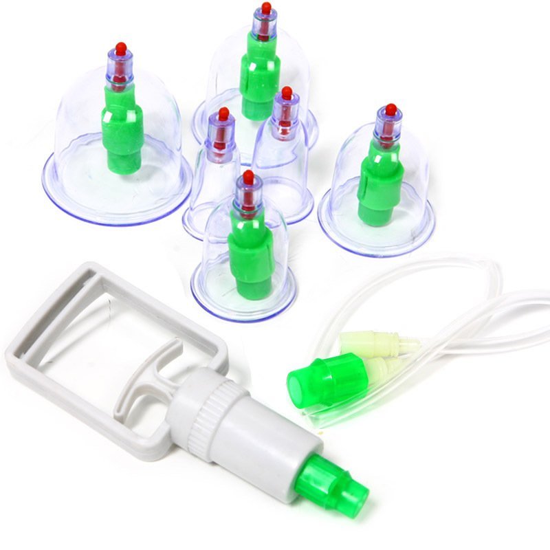 Hijama